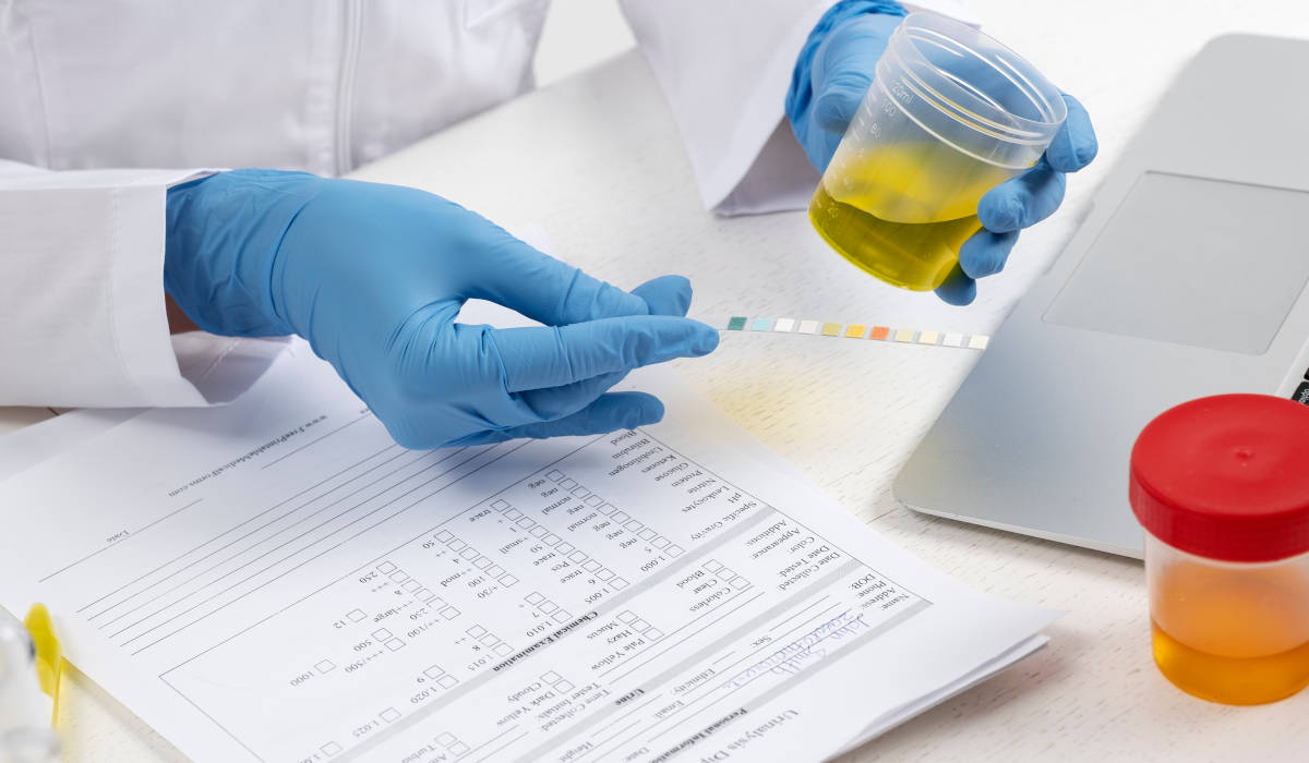 Exame toxicológico para CNH